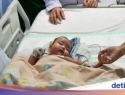 Ahli Kebugaran RSU Soetomo Pisahkan Kembar Siam Dempet Bokong, Satu Bayi Meninggal