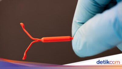 Benarkah Alat KB IUD Hormonal Memicu Kanker Payudara? Ini Kata Ahli