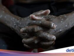 Makin Ngeri, Kematian Mpox ‘Cacar Monyet’ Di Afrika Sudah Lebih Untuk 800 Tindak Kejahatan