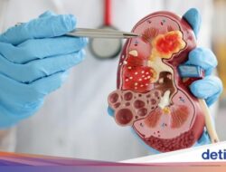 10 Tanda-Tanda yang Muncul Di Ginjal Bermasalah, Bengkak-Rasa Gatal Ke Kulit