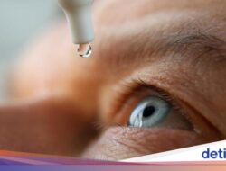 Wanita Ini Jalani Prosedur Oplas Bola Mata, Ganti Warna Di Cokelat Hingga Biru