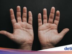 Telapak Tangan Mudah Berkeringat Tanda Punya Gangguan Jantung? Gini Kata Ahli Kemakmuran