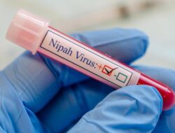 Heboh Patogen Nipah, Pakar Minta Pelancong India yang Masuk RI Diskrining Ketat
