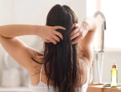 Musim Dingin Bikin Rambut Rontok, Ini Tips Mengatasinya