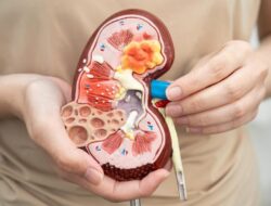 Ini Jenis Kanker Ginjal yang Banyak Ditemukan Di Dewasa