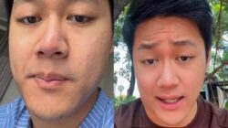 Pria Jakut Kena Kanker Limfoma Di Usia 25 Tahun, Inikah Penyebabnya?