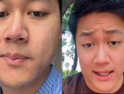 Pria Jakut Kena Kanker Limfoma Di Usia 25 Tahun, Inikah Penyebabnya?