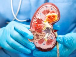 Perkara Pidana Hukum Gagal Ginjal ‘Meledak’ Ke Malaysia, Inikah Pemicunya?