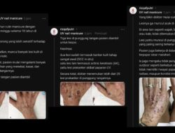 Wanita 52 Tahun Kena Kanker Kulit usai Manicure UV Nail Lamp, Inikah Penyebabnya?