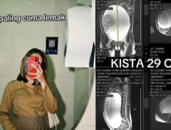Viral Perut Wanita Bekasi Membesar Dikira Lemak, Ternyata Kista Ovarium 29 Cm